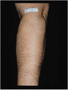 arm-before.jpg
